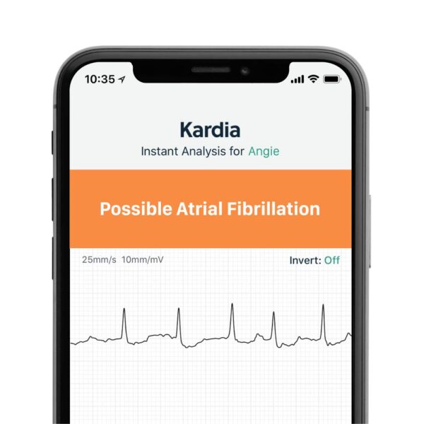 Alive Cor Kardia Mobile mobile EKG be in plastic