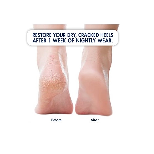 Are your cracked heels causing alarm?