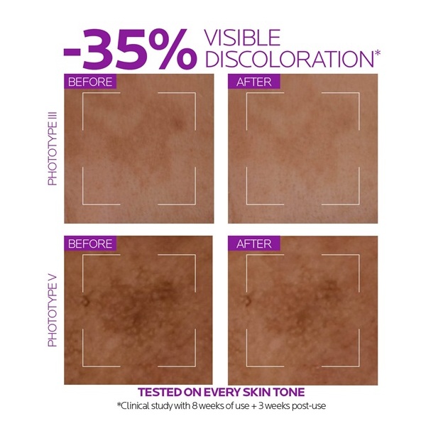 La Roche-Posay La Roche Posay Niacinamide 10 Face Serum, Brightening And Anti-Aging Facial Serum With 10% Niacinamide, Reduces The Look Of Dark Spots, Discoloration, And Uneven Skin Tone - Image 3